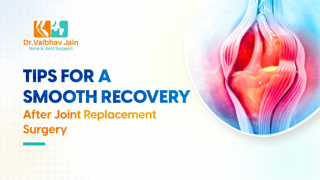 Tips For A Smooth Recovery After Knee Replacement Surgery