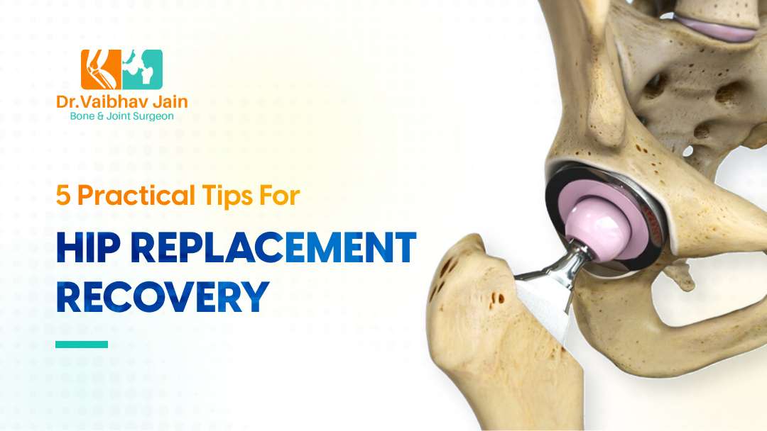 5 Practical Tips For Successful Hip Replacement Recovery Dr. Vaibhav Jain