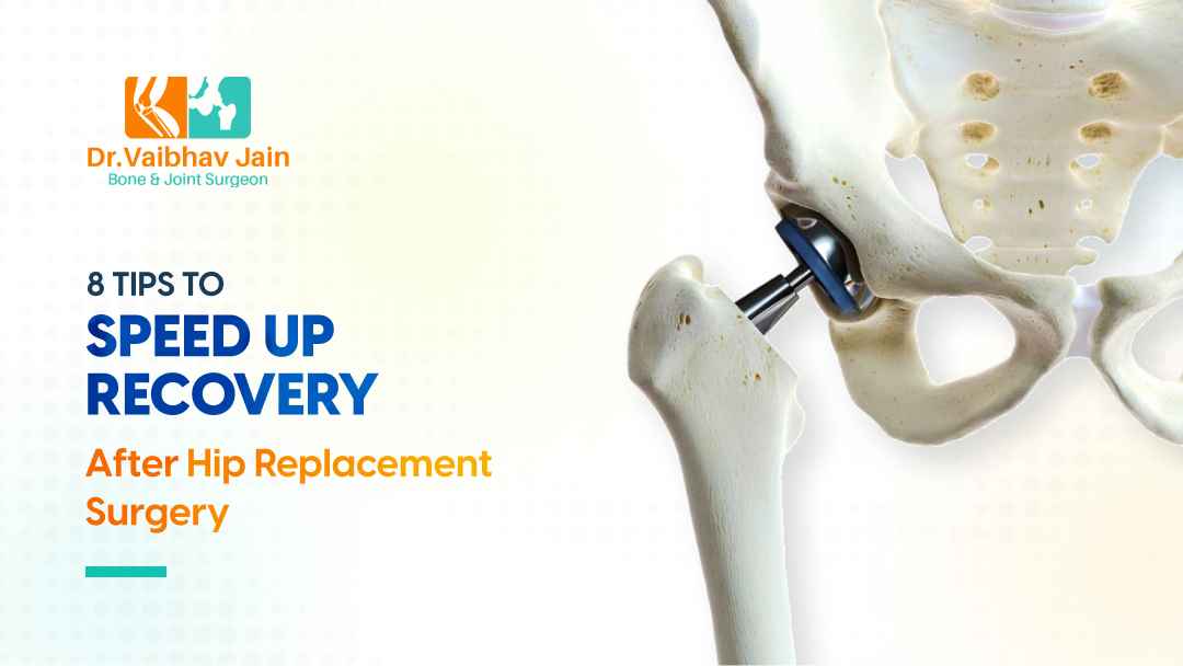 8 Tips To Speed Up Recovery After Hip Replacement Surgery
