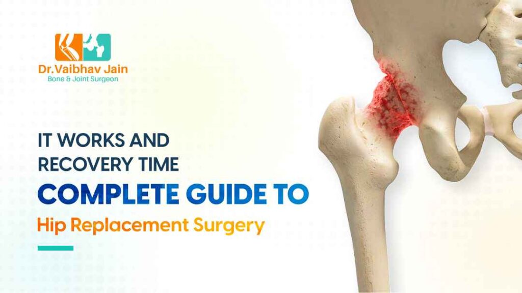 Complete Guide To Hip Replacement Surgery How It Works And Recovery Time Dr. Vaibhav Jain