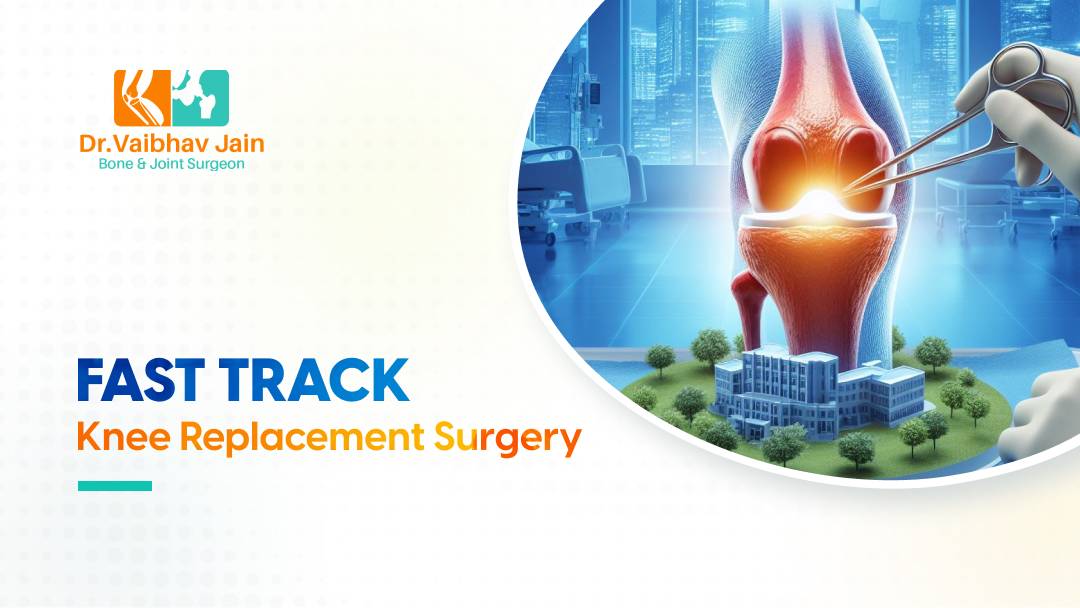 Fast Track Knee Replacement Surgery: Say Goodbye To Knee Pain