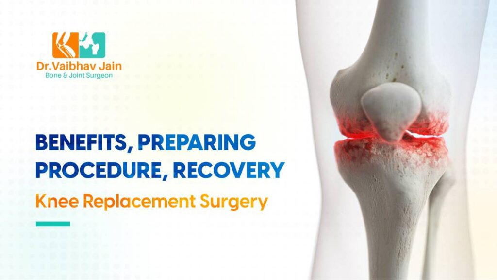Knee Replacement Surgery In Delhi - Experience Lasting Relief