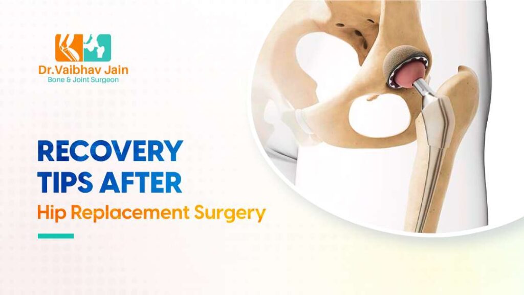 Recovery Tips After Hip Replacement Surgery For Speedy Recovery