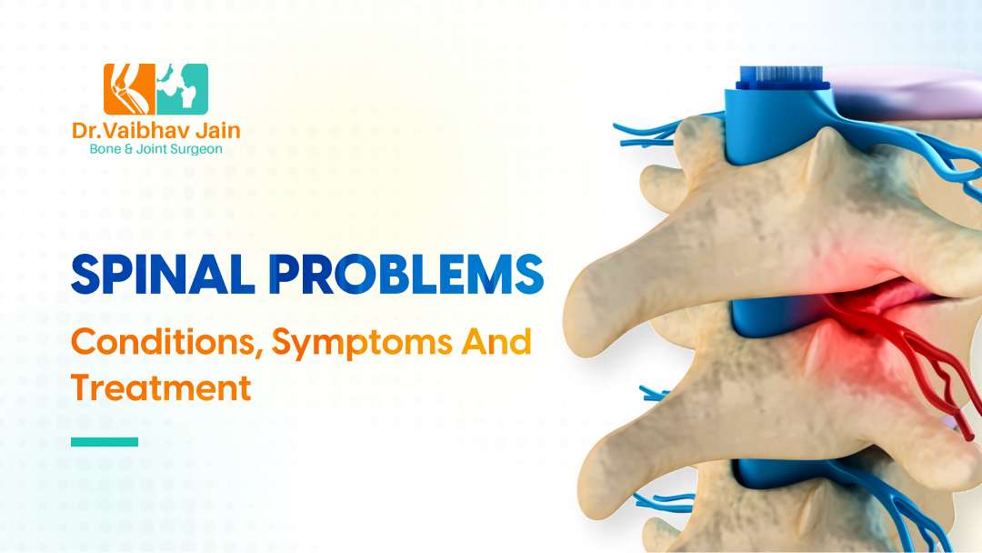 Spinal Problems Conditions, Symptoms And Treatment