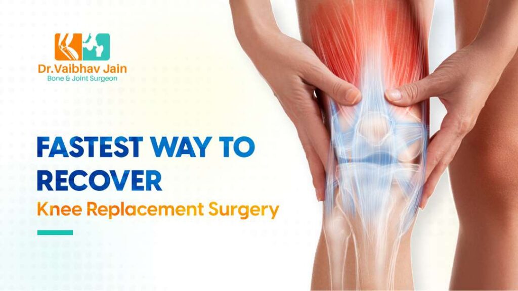 The Fastest Way To Recover From Knee Replacement Surgery