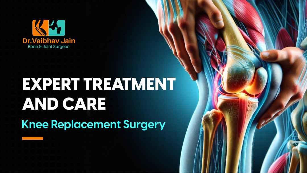 Top Knee Replacement Surgeon In Delhi – Expert Treatment And Care