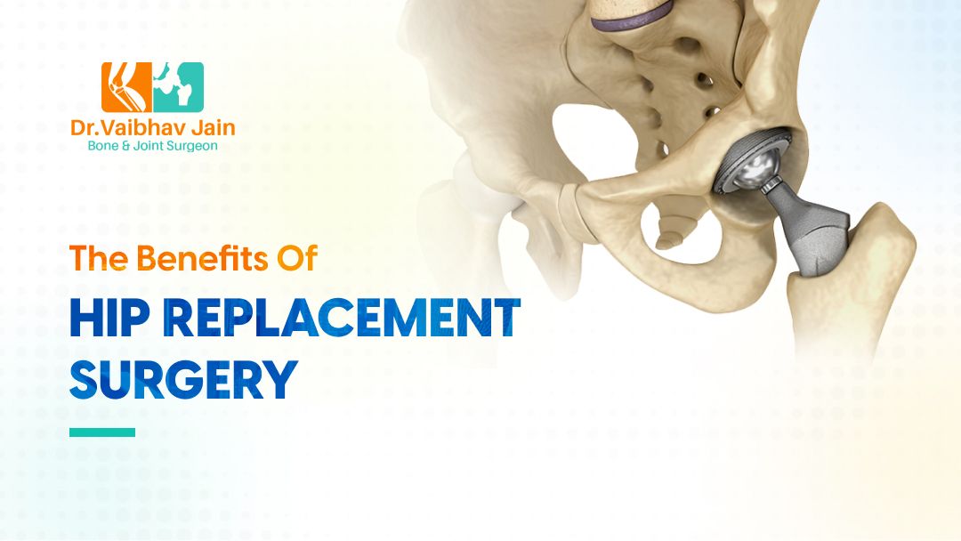 What are the benefits of hip replacement surgery?