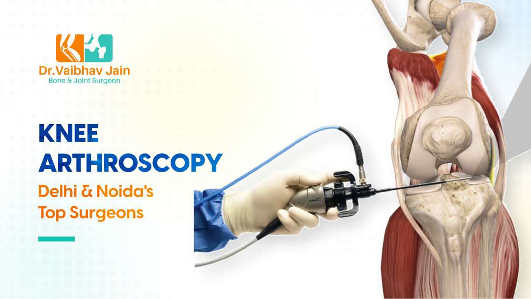 What Is Knee Arthroscopy Surgery Best Arthroscopic Surgeon In Delhi & Noida.
