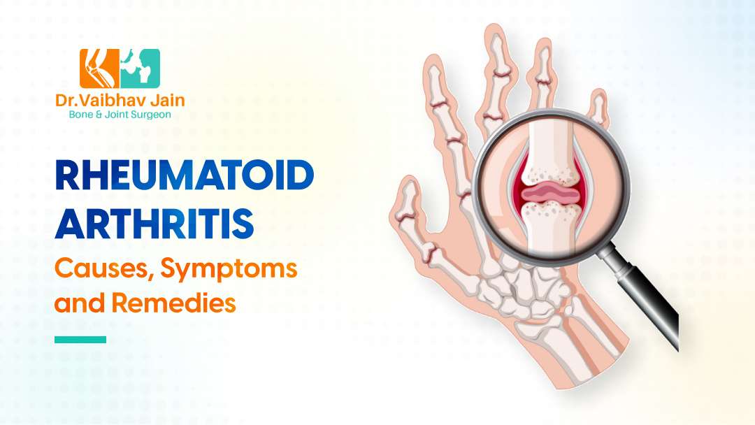 What Is Rheumatoid Arthritis Know Its Causes, Symptoms And Remedies.