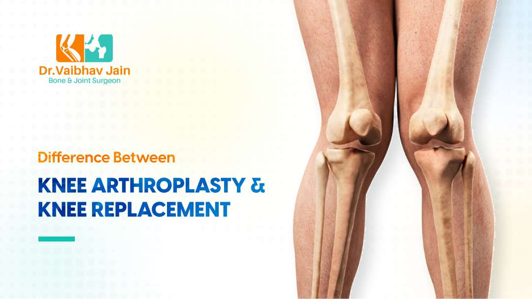 What Is The Difference Between Knee Arthroplasty And Knee Replacement Dr. Vaibhav Jain
