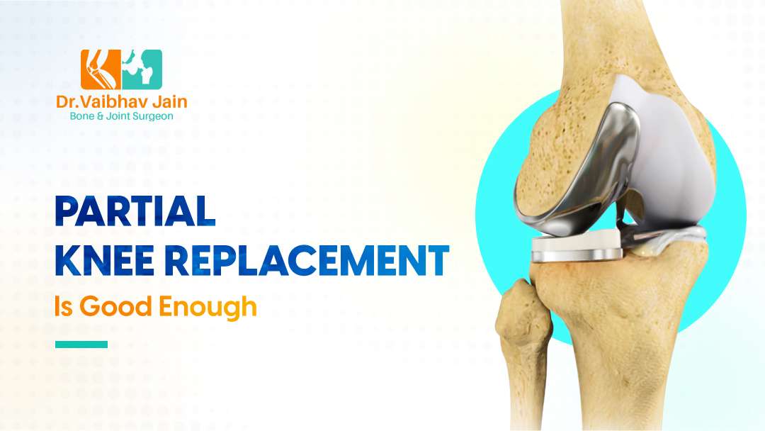 Why Do Full Knee Replacement When Partial Knee Replacement Is Good Enough Dr. Vaibhav Jain