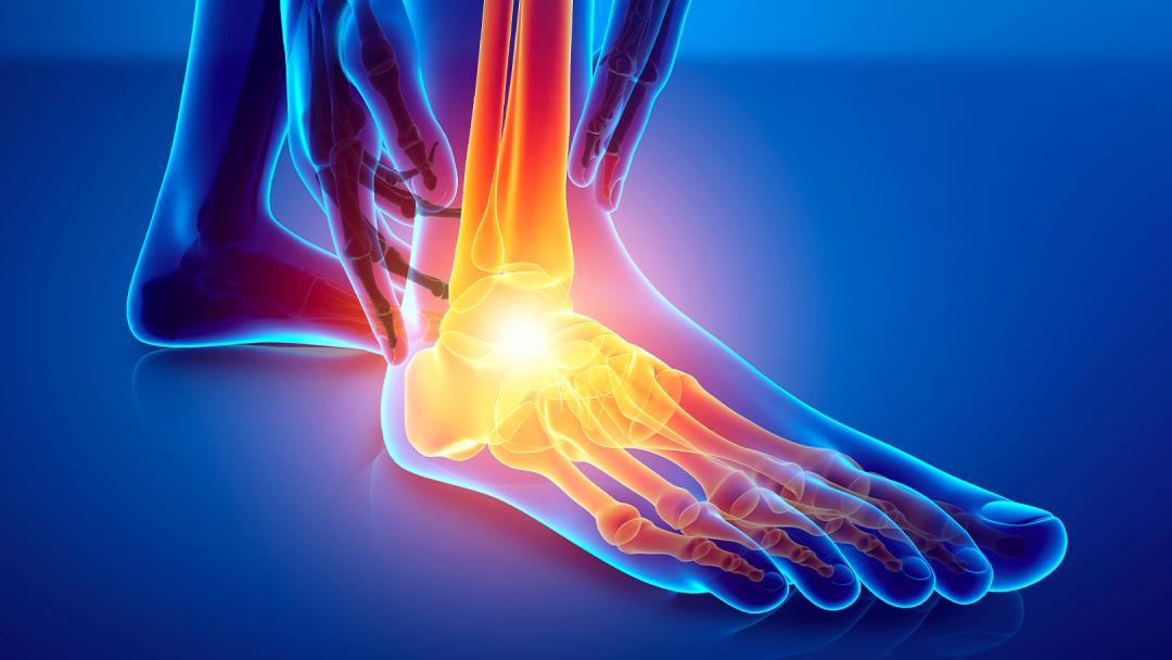 foot ankle treatment image