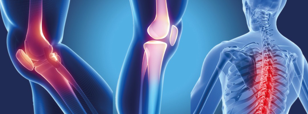 Joint Replacement Surgery doctor in Delhi and Noida