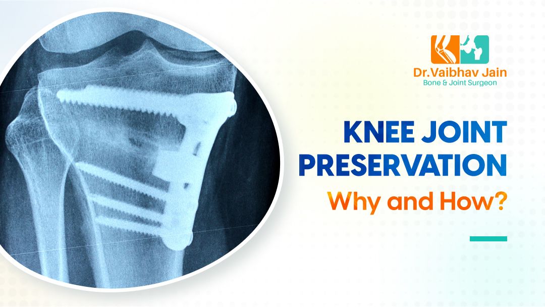 Knee joint preservation - Why and How?