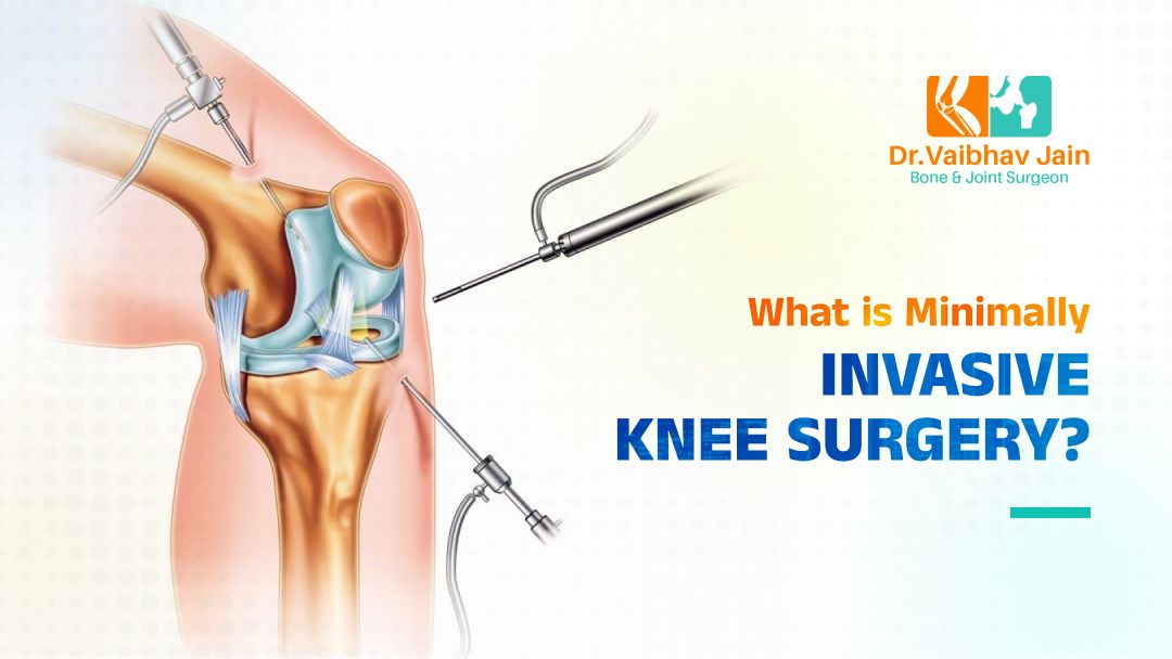 Benefits of Minimally Invasive Knee Surgery