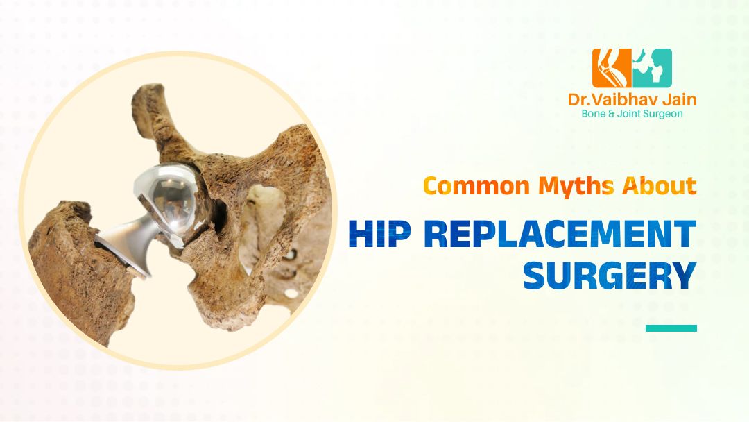 Common Myths About Hip Replacement Surgery - Dr Vaibhav Jain