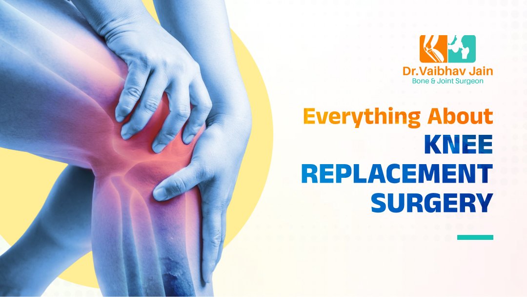 Everything About Knee Replacement Surgery in Faridabad