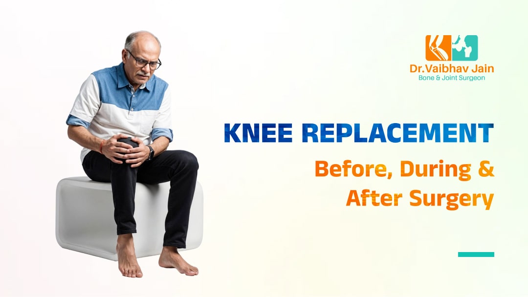 Best Orthopedic Surgeon for Knee Replacement