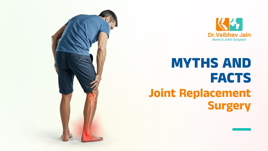 Common Myths and Facts about Joint Replacement Surgery