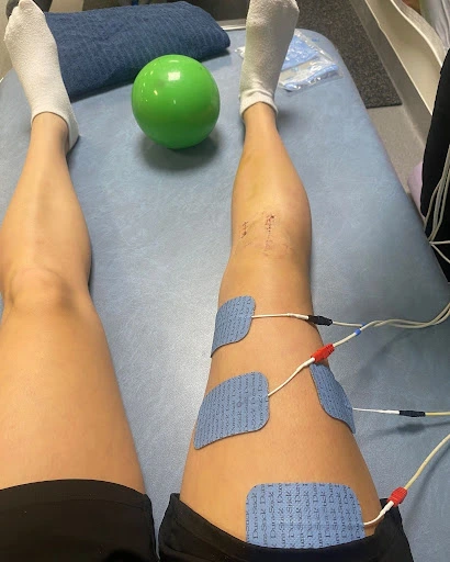 popping sound in knee acl injury